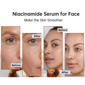 Niacinamide 10% + Zinc 1% Serum